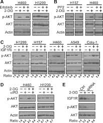 What does 2dg stand for? The Glycolytic Inhibitor 2 Deoxyglucose Activates Multiple Prosurvival Pathways Through Igf1r Journal Of Biological Chemistry