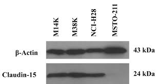 Malignant pleural mesothelioma is the most common primary tumor of the pleura. M14k And M38k Malignant Pleural Mesothelioma Cell Lines Preserve The Same Claudin Based Phenotype In Vivo In Vivo