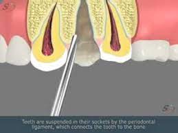 Tooth Extraction Procedure Fanatical Dental Implants Before And After Life Dentistlo Tooth Extraction Aftercare Tooth Extraction Healing Tooth Extraction Care