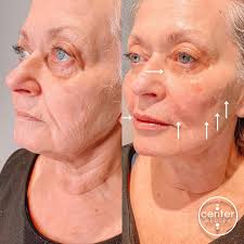 𝐑𝐨𝐠𝐞𝐫 𝐘𝐨𝐧𝐜𝐞 𝐑𝐍 (@right.dose.roger) • Instagram photos and videos