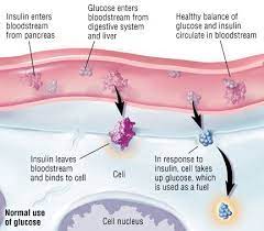 Penyakit diabetes melitus tipe 1 (dmt1) adalah penyakit autoimun yang ditandai dengan gangguan metabolisme: Type 1 Diabetes Mellitus Guide Causes Symptoms And Treatment Options