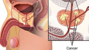 Pin En Salud