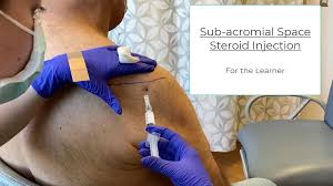 Image result for Subacromial Space Injection