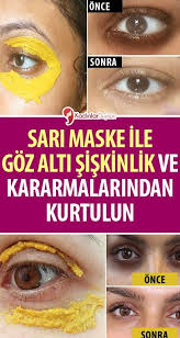 Sari Maske Ile Goz Alti Siskinlik Ve Kararmalarindan Kurtulun Movie Posters