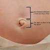 Bathing your baby too often can dry out her skin. 1