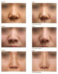 Welcome to the website for re plastic surgery, based in kuala lumpur, malaysia. Jk Jk Plastic Surgery Consultation Centre Penang Malaysia Facebook