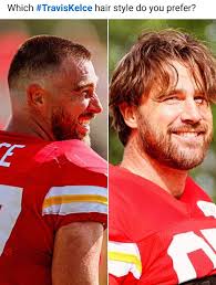 I like the short hair! Which #TravisKelce hair style do you prefer? E