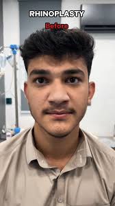 Dr Habib Hair Transplant, Cosmetics & Plastic Surgery Clinic