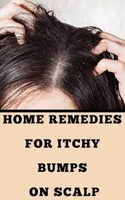 What Causes Itchy Bumps On Scalp And How You Can Get Rid Of Them Home Remedies Itchy Bumps Remedies