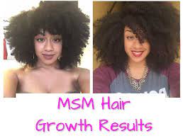 We created liquid gold hair products to help people just like you grow their hair longer and faster. Msm Hair Growth Before And After Pictures Msm Powder Oil Results