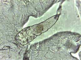 Image result for Demodex brevis