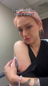 Understanding Type 1 Diabetes Management