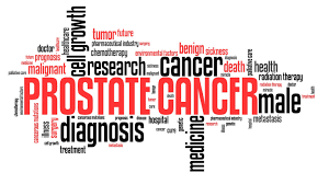 Dull, deep pain or stiffness in your pelvis, lower back, ribs, or upper thighs; Prostate Cancer For Me It Was A Silent Disease They Were No Symptoms