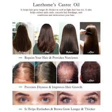 Jamaican black castor oil (jbco) is an unrefined variety of this oil; Pure Jamaican Black Castor Oil Hair Eyebrow Growth Hair Loss Treatment Shopee Malaysia