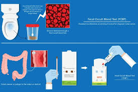 Image result for Blood in stool