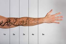 Maybe you would like to learn more about one of these? The Healing Process What To Expect After Tattoo Removal In Nyc