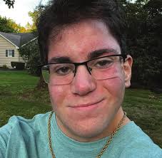 2024 IMPACT REPORT WITH CANCER AND BLOOD DISORDERS WITH CANCER AND BLOOD  DISORDERS