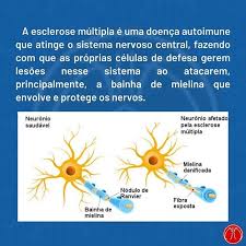 Nervoso central, caracterizada por um processo inflamatório de etiologia autoimune O Laco Laranja Posts Facebook