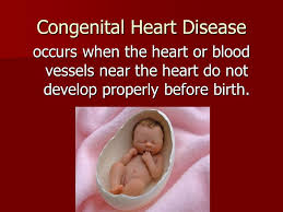 Congenital Heart Defects By Kimberly Napper. Congenital Heart Disease  occurs when the heart or blood vessels near the heart do not develop  properly before.
