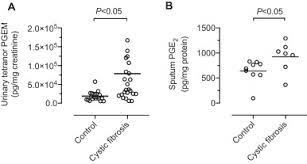 Spoj (sphere online judge) is an online judge system with over 315,000 registered users and over 20000 problems. Prostaglandin E2 And Phagocytosis Of Inhaled Particulate Matter By Airway Macrophages In Cystic Fibrosis Journal Of Cystic Fibrosis