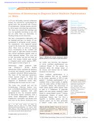Typical Appearance Of Vulvar Vestibular Papillomatosis. | Download  Scientific Diagram