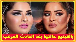 بالفيديو حالة هيا الشعيبى بعد حادث مرعب وردها النارى على بدر صالح وتكشف فنانة سبب انفصالها فنيا عن طارق العلى أخبار النجوم تعرف على التفاصيل بالفيديو المرفق ع
