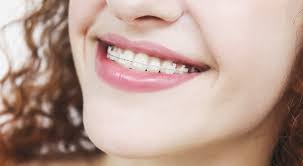 The average cost for braces treatment without insurance is between $3,000 and $7,000. Ceramic Braces Vs Metal Braces Plus Costs Faqs Ask The Dentist