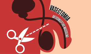 Es la más extendida en todos los centros sanitarios, consiste en y ya no lo es, señala cruz. Vasectomia El Anticonceptivo Masculino Que Debes Conocer Diario El Observador
