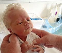 Blonde hair evolved independently in melanesia. same goes for red hair. 45 Adorable Babies Born With Lots And Lots Of Hair