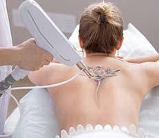 K w., fair oaks, ca. Tattoo Removal Specialist Hanford Ca Manteca Ca Las Vegas Nv Porterville Ca Santa Barbara Ca Sparks Nv Stockton Ca Visalia Ca Lux Dermatology Dermatologists