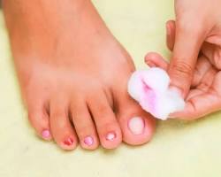 Image of Removing old nail polish from feet