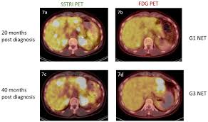 Our veterinarians and staff are committed to working as a team to provide your pets with the best possible. Dual Somatostatin Receptor Fdg Pet Ct Imaging In Metastatic Neuroendocrine Tumours Proposal For A Novel Grading Scheme With Prognostic Significance Abstract Europe Pmc