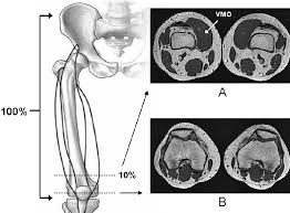 Mri of the knee jennifer swart, m.d. Selected Axial Magnetic Resonance Images A Vastus Medialis Obliquus Download Scientific Diagram