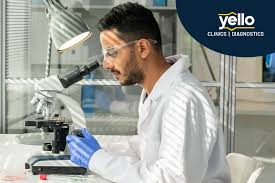 Image result for Monospot