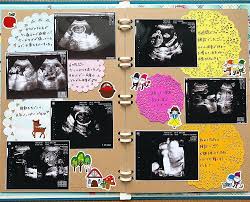 miiさんはinstagramを利用しています エコーアルバムのこれまた1ページ 少しずつ大きくなる我が子が愛おしくて 早く会いたいなぁ っていつも思ってた 何度も見返してたエコー写真 アルバム 手作り エコー写真 アルバム マタニティ アルバム