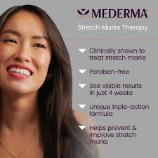 Mederma Stretch Marks Therapy, Helps Prevent and Treat Stretch Marks, 5.29  Ounce