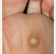 Find and research urgent care clinics, including clinic ratings, addresses, phone numbers, affiliated physicians, and more. Active Foot Care Clinic Opening Hours 525 Park Rd N Brantford On