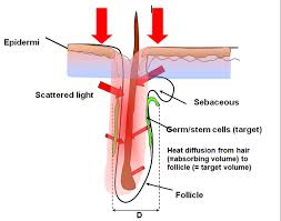 What laser power parameters do you need to follow for hair removal? Laser Hair Removal Claire Louise Skin Aesthetics