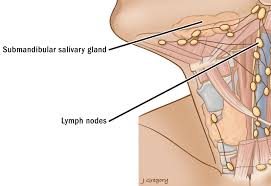 Metastatic Lymph Nodes Thanc Guide