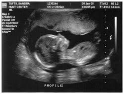 We did not find results for: Free Ultrasound Women S Center Of Lafayette