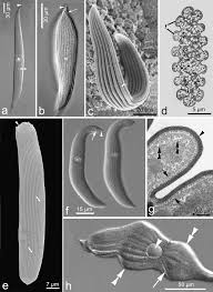 Image result for Lankesteria