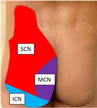 (simply, the spinal nerves exit the spinal column and split at the s2, s3, and s4 vertebra to form the sacral plexus, the nerves which provided motor and sensory nerves for the posterior or back of the thigh, most of the lower leg, and foot, and part of the pelvis. Superior Cluneal Nerve Entrapment Wikimsk
