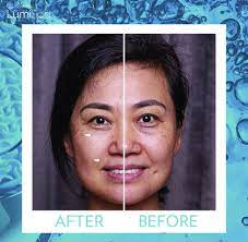 Ageloc Lumispa Before After Produits Nuskin Nuskin Business Nuskin Avant Apres Nuskin Visage Dentifrice Nuskin Beauty Gadgets Bright Skin Skin So Soft