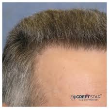 Pin De Greft Star Em Sac Ekimi Samsun Aniversario