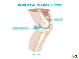 Pin On Exercise