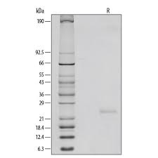 Recombinant Mouse IL-6 Protein (406-ML): Novus Biologicals