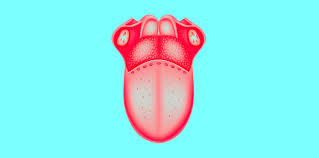 Do you know whether or not if you're right for it? Are You A Supertaster