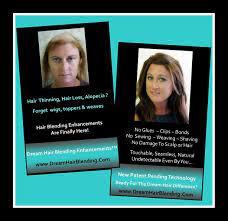 Pin On Womens Hair Thinning Hair Loss