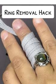 Image result for Ring Removal