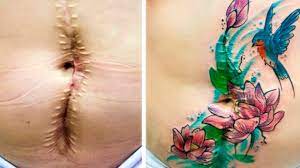 This is due to the constant changes in skin tones from blood flow, body temperature, and tanning. 21 Tattoos Turn Scars That People Don T Want To Hide Anymore Into Art Youtube